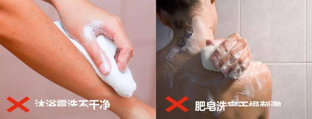 导致皮肤无故发痒,长痘,粗糙,起鸡皮红疹,他们的分泌物甚至会加重体臭