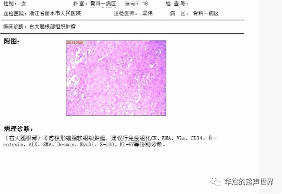 患者住院在骨科行手術治療,手術記錄如下:取大腿近端內側縱行切口長約