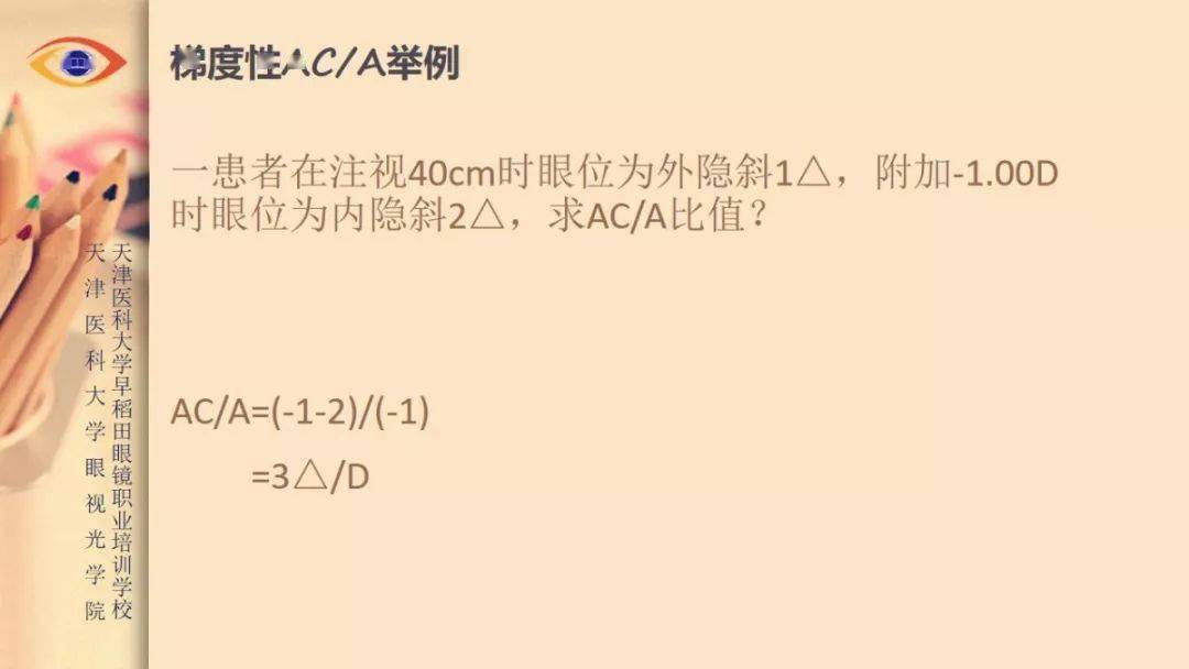 【眼視光】 ac/a的定義和測量方法