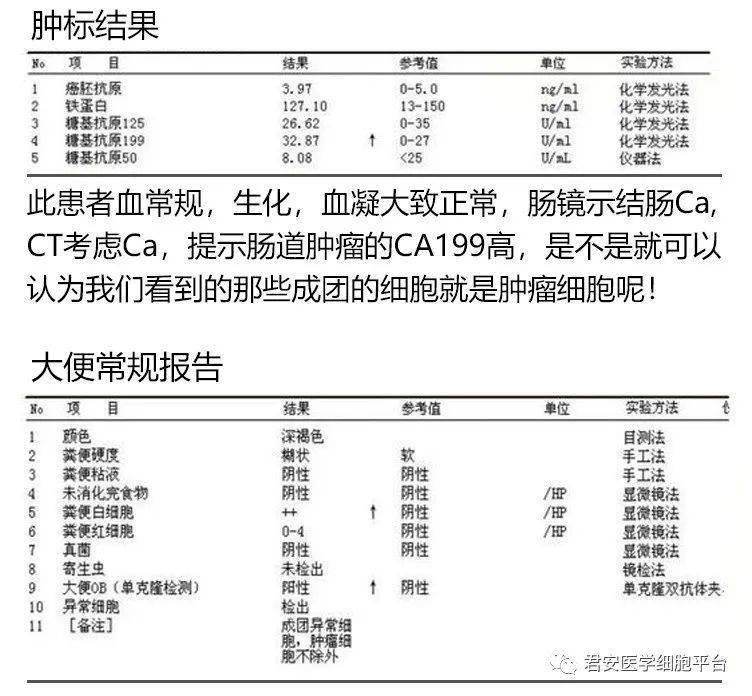 女,43歲,三個月前無明顯誘因出現大便帶血,呈間歇性,無黑便膿血便,無