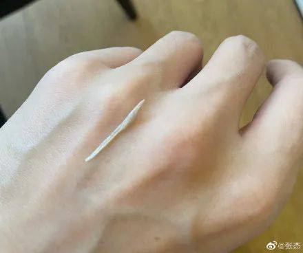 张杰|知名男歌手连夜麻醉做……很多人都遇到过