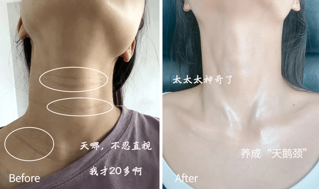 体脂率多少会出现下颌线 e909e4acd0c746bb92f17fdc4ca49b16.png