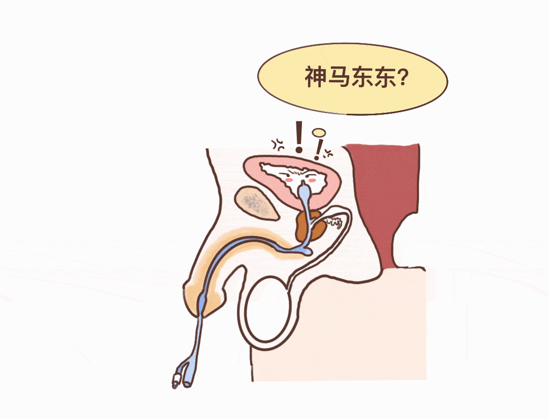 bladder discomfort)尿管相关膀胱刺激征被称为严重的伴有烦躁不安等