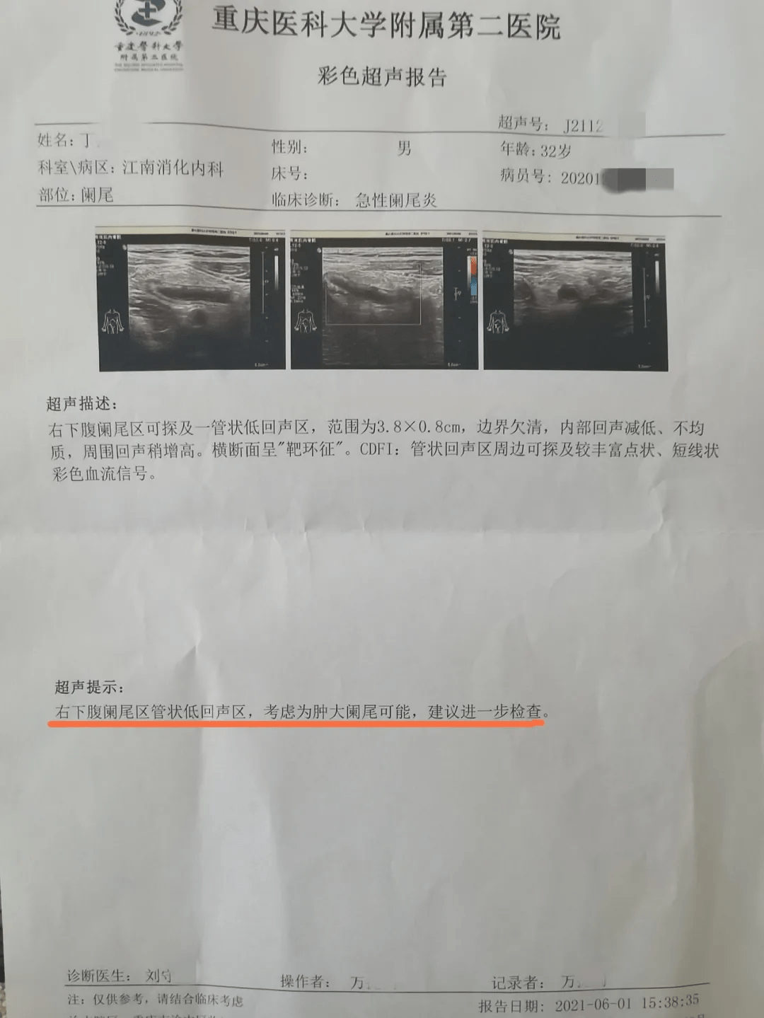 医案分享小品前胡汤治愈急性阑尾炎