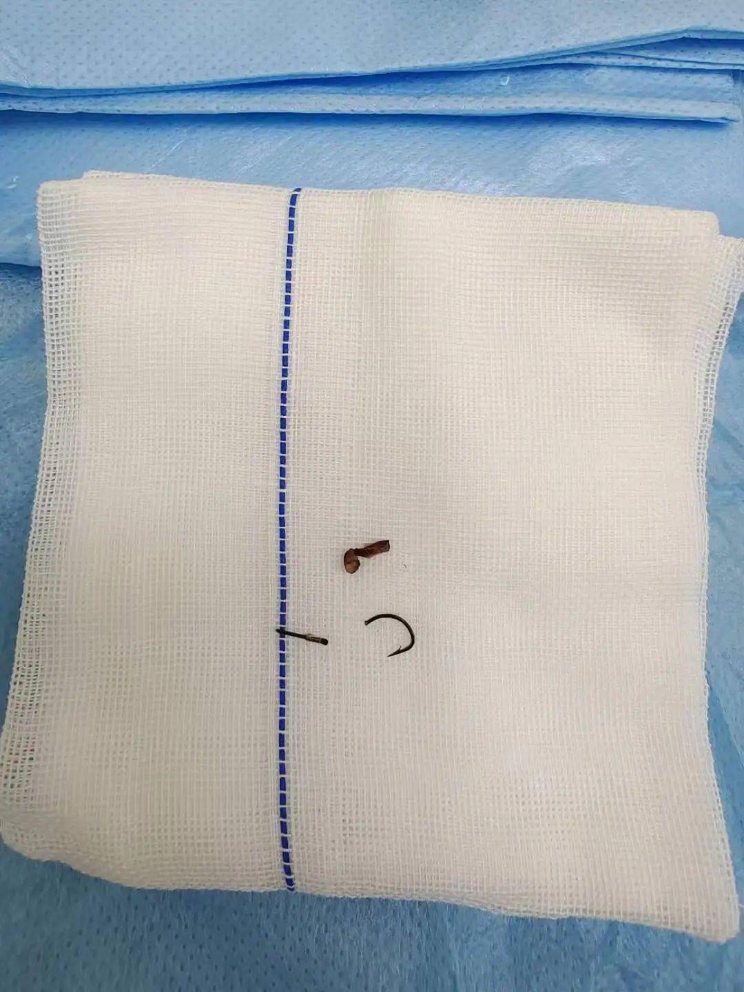 手术|看着都疼！黑龙江一男子钓鱼时，鱼钩不慎被射进眼内！