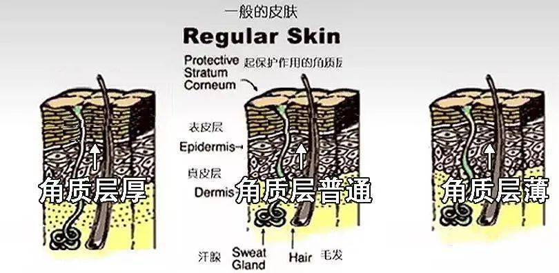 果酸|年轻人的“刷酸自由”，烂脸还是换脸？