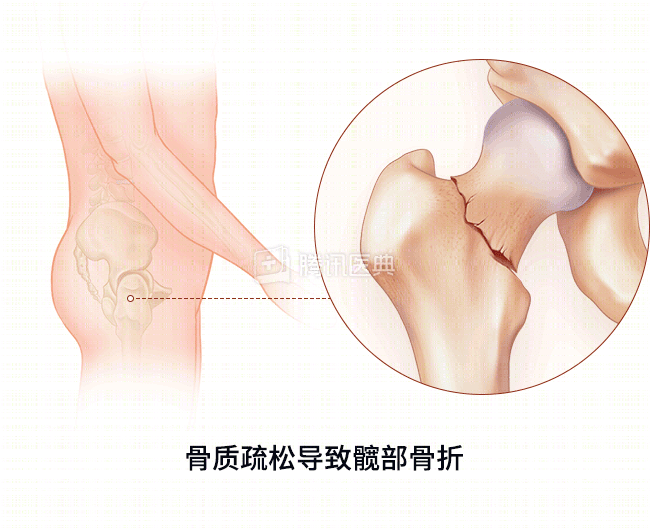 老年人怎么补钙（老年人怎么补钙效果最好）