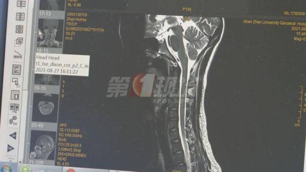 检查|全身换血！男子手脚“软趴趴”9年，在深圳找回了“力量”…