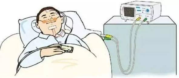 阻塞|打鼾的人注意！呼噜声越大，越要抓紧看