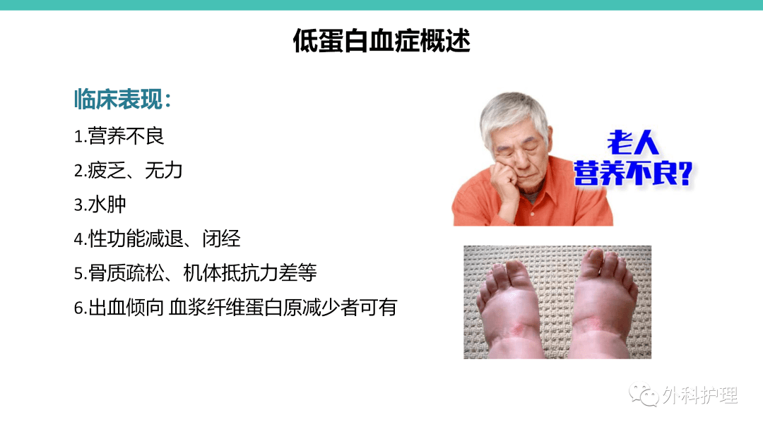 【ppt】一例老年头皮裂伤伴低蛋白血症患者的护理