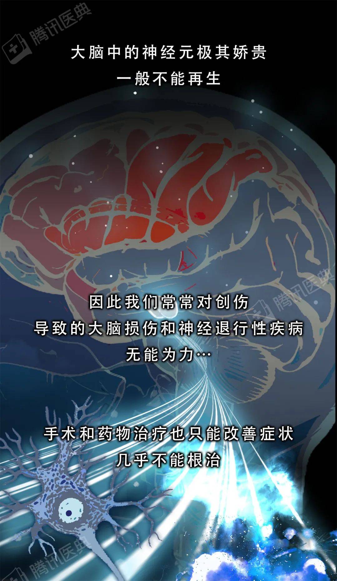 醫典|大腦里被稱作“膠水”的細胞，關鍵時刻會“豁出命”救你