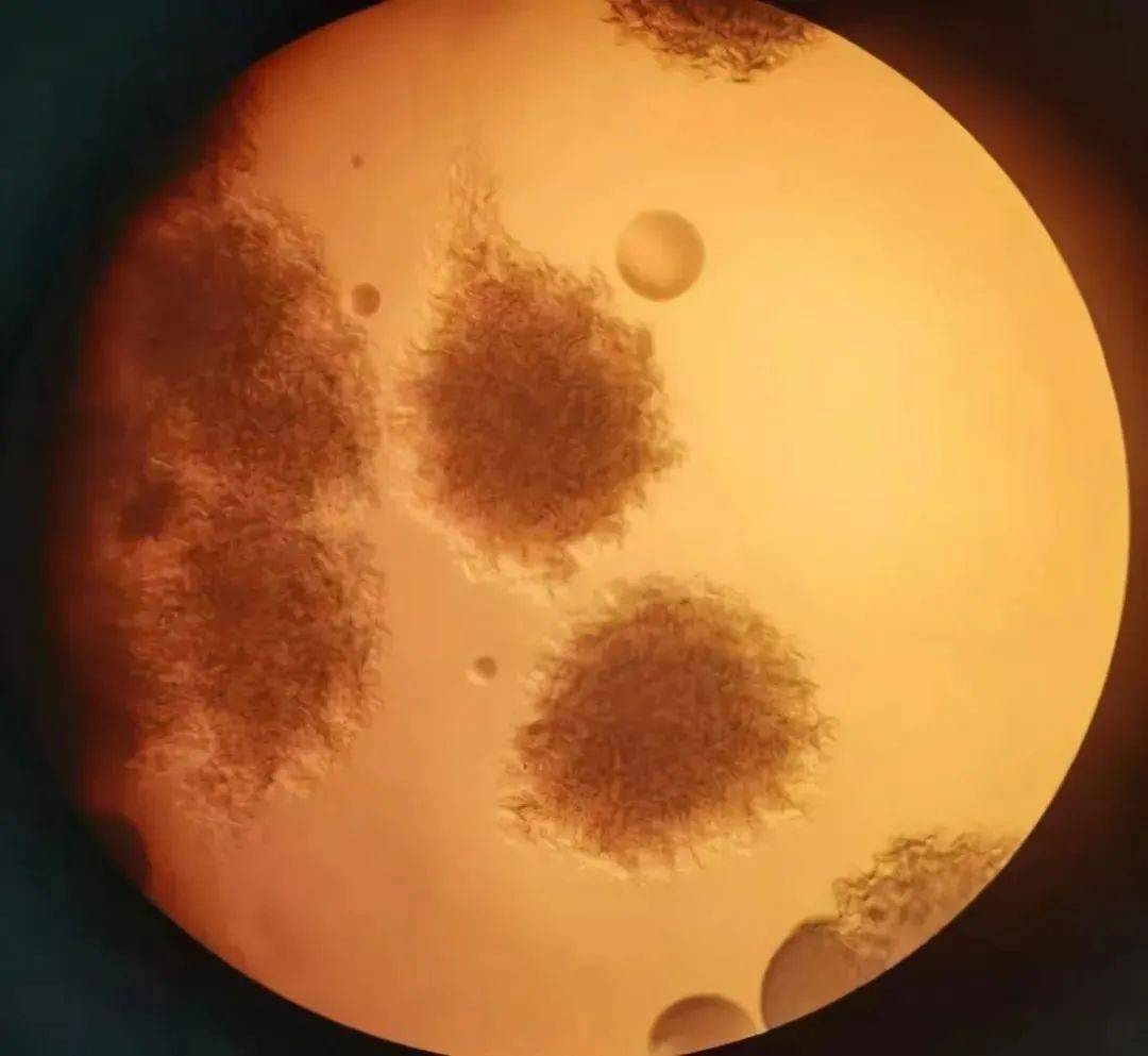 炭疽芽胞杆菌 炭疽芽孢杆菌图片