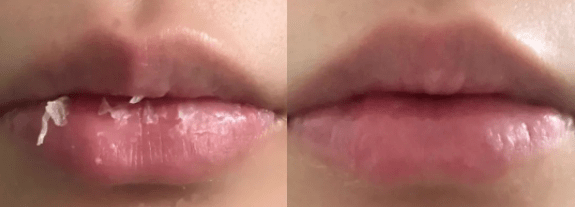 唇膏|秋冬嘴唇干燥、起皮？口碑zui好的唇膏就是它LaMer唇膏