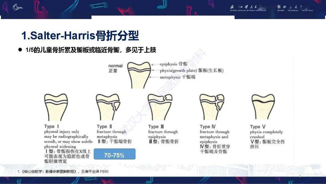 stanford分型图片