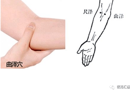 曲泽穴:肘微屈,在肘横纹中,肱二头肌的内侧缘