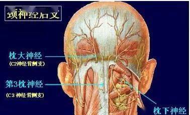 分类枕大神经痛的解剖学起因大致可归纳为:1
