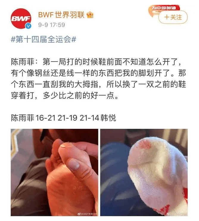 奥运冠军比赛时脚被划伤 李宁紧急回应：同款鞋已下架(图2)