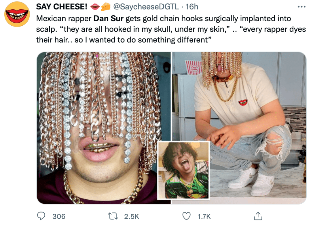 太疯了脑门镶钻后又有歌手钻开头骨植满大金链网友嘲翻