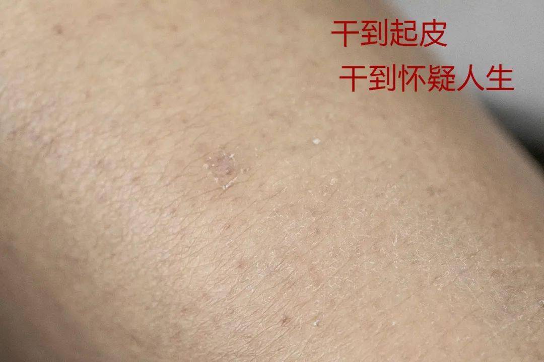 中国|观方好物 | 北京协和医院：我们从未出过维E乳