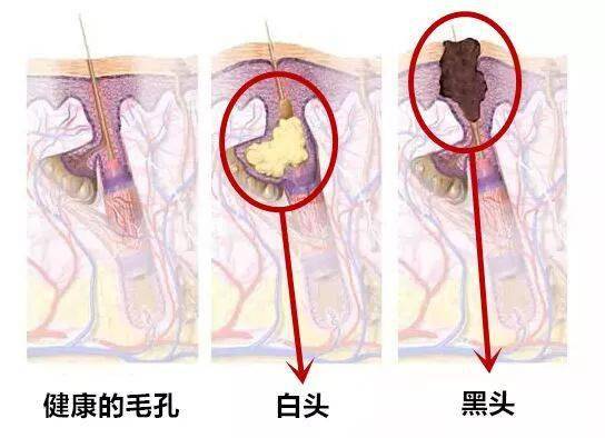 因为|有哪些不贵大碗的好面霜？这个大牌的要我说是第1名！
