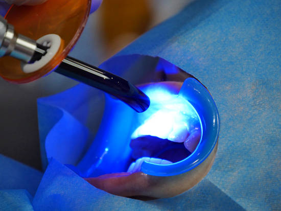 医疗|打地鼠式牙齿保卫战