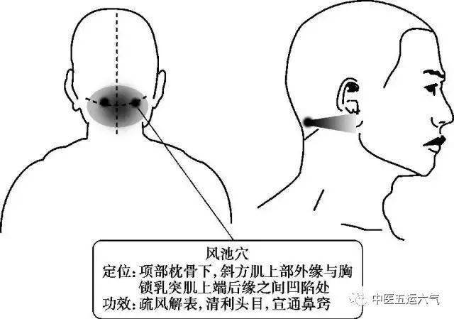 (3)风池穴:双点温和灸,自觉热感深透或向四周扩散或沿督脉上下传导,灸