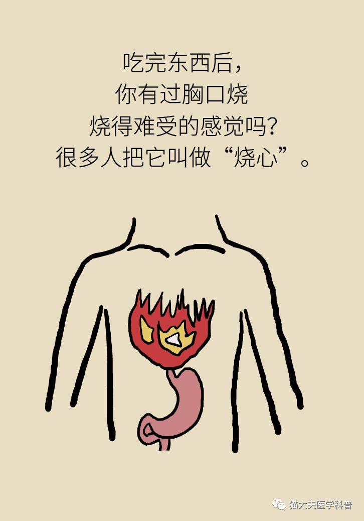 烧心|烧心烧得难受？6个方法可缓解