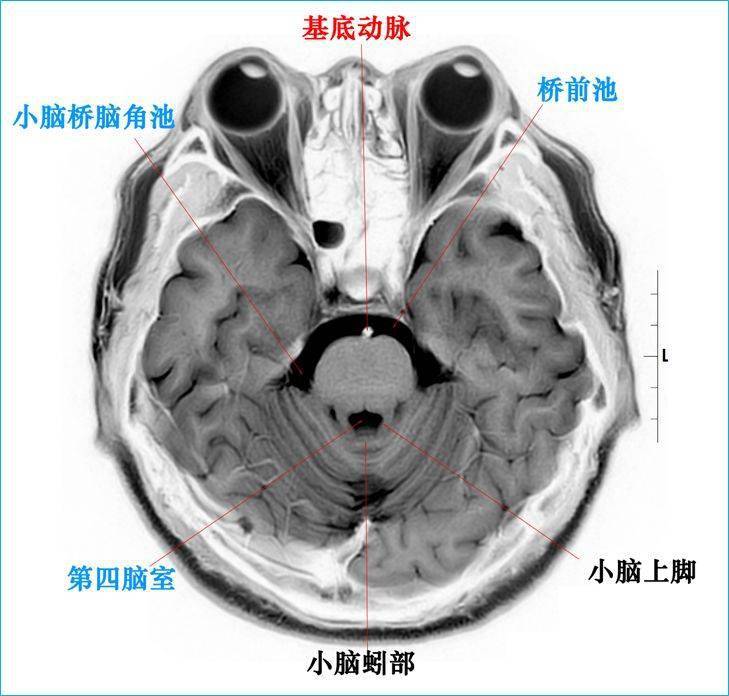 这个高清颅脑断层解剖图谱实在太棒了  磁共振 大体标本