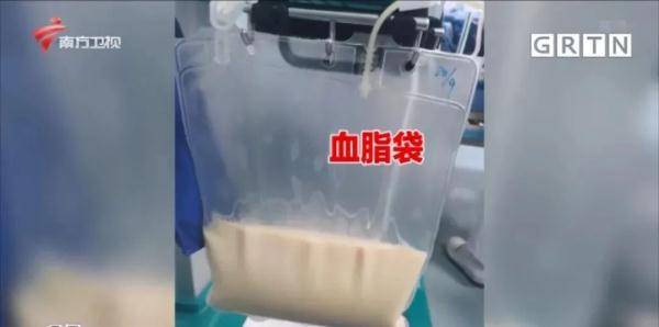 小林|佛山一男子血液成“牛奶色”，与其饮食习惯有关！