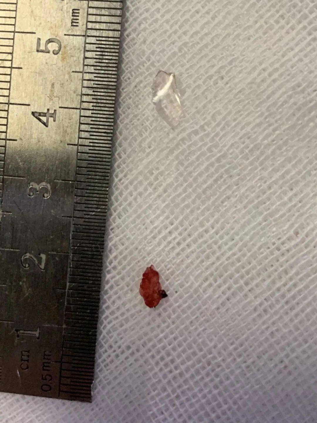 孟先生|凌晨，大连男子被送到医院！医生：食管被割破