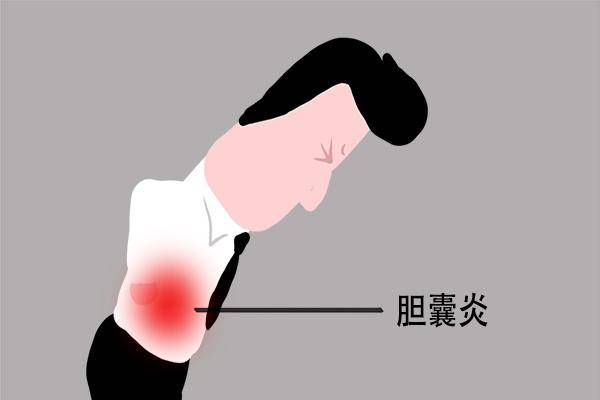 炎症|胆囊炎怎么发生的?什么样的人容易得胆囊炎?