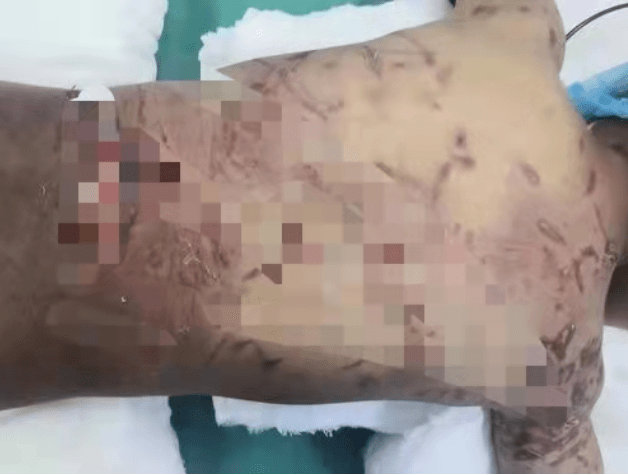 宁夏|警惕丨宁夏3岁男孩被狗严重咬伤致休克，这些情况千万小心！