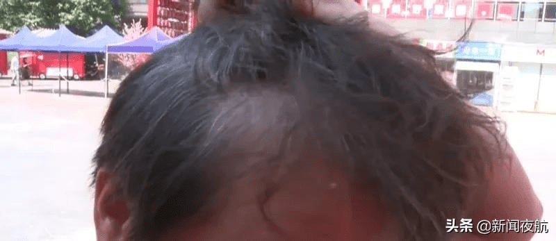 stvxwf|女子花4万“白发转黑”！体验后目瞪口呆：也太简单粗暴了吧