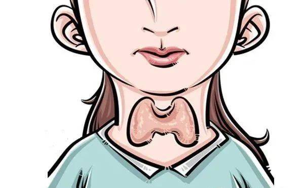 控制|杭州一美女主播秒变“更年期”，竟是因为这种病