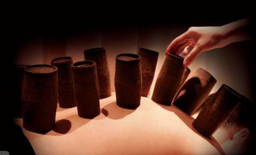 中医拔火罐的罐子种类你知道吗该怎么用一文全知道