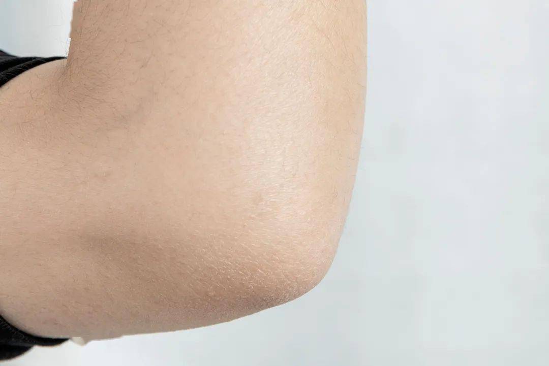 屏障护肤行业真大佬：全国皮肤科第一，一个面霜做3年，有多好用？