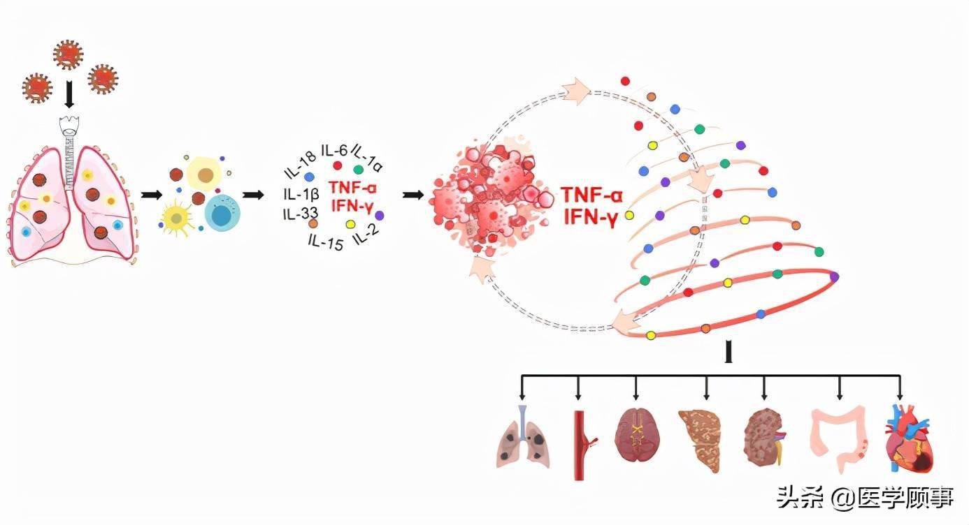 细胞因子风暴示意图图片