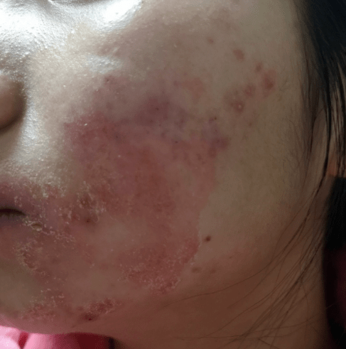 屏障护肤行业真大佬：全国皮肤科第一，一个面霜做3年，有多好用？