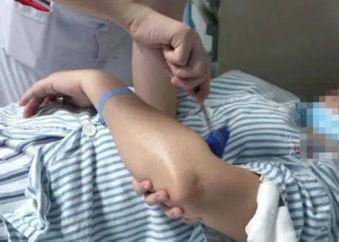 球菌|警惕！女子杀鸡之后失去意识，竟是患上致死率40％的重疾