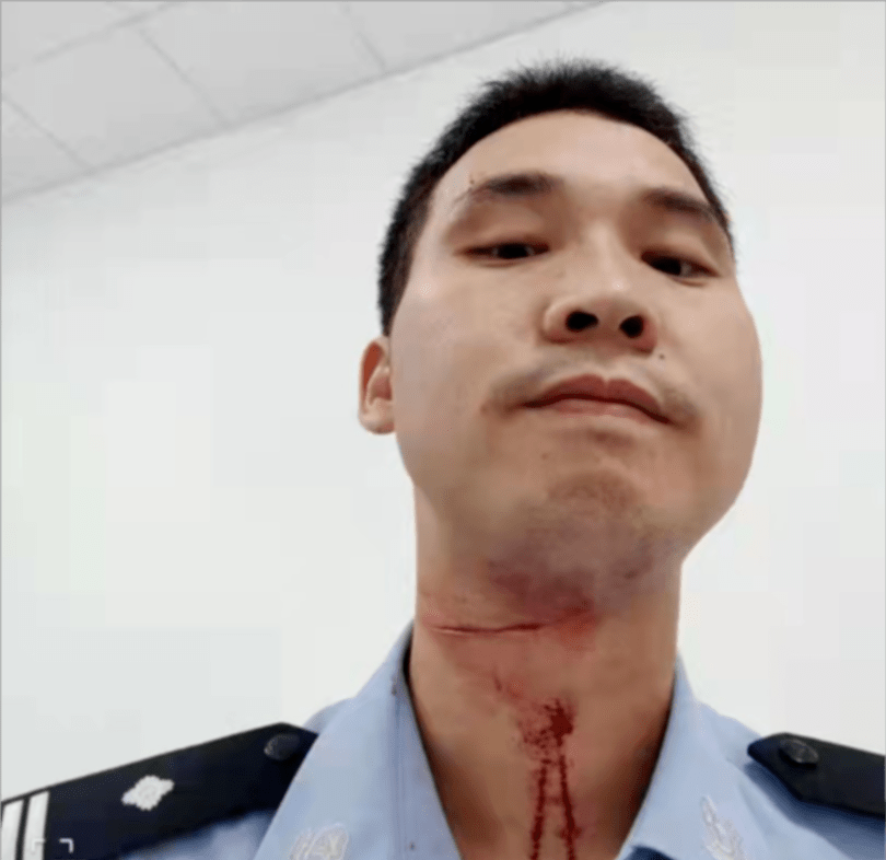 中间护栏时 因衣角被护栏勾住导致身体失去重心摔倒 脖颈被锐器划伤