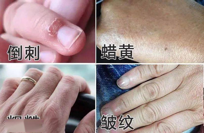 手部网友0差评推荐，3效和一滋养力Max，颜值也在线?！