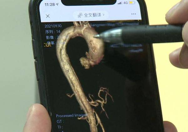 麻将|致死率近100%！阿姨搓了5个钟麻将，突然胸痛