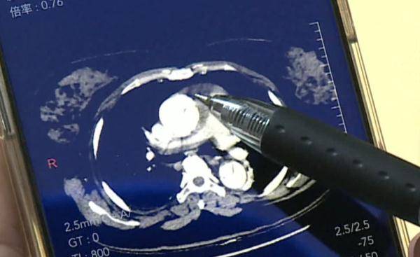 麻将|致死率近100%！阿姨搓了5个钟麻将，突然胸痛