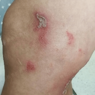 一条小虫差点毁容遇到这样的小虫千万不能拍