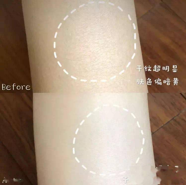 因为北京协和医院出的“镇院硅霜”,到底有多好用?