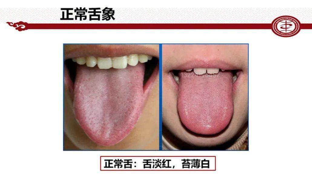 然其理归结到一点,阳痿乃阳道不兴,功能失用之故,其基本病理变化多为