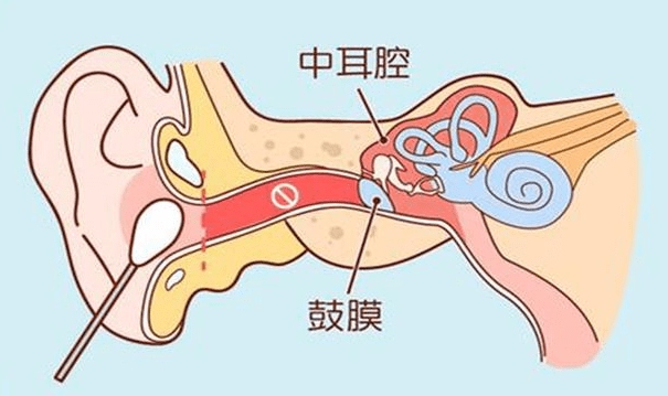 一定要重視孩子半夜突然耳朵痛當心急性中耳炎