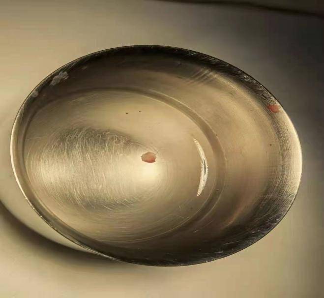 宋先生|小伙嘴角歪斜原是罹患四大神经系统疾病，精准评估后各个击破