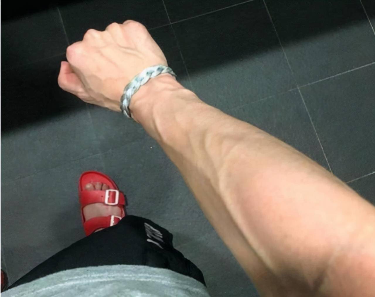 为何有些人手臂上青筋暴起有些人却看不到青筋哪种更健康