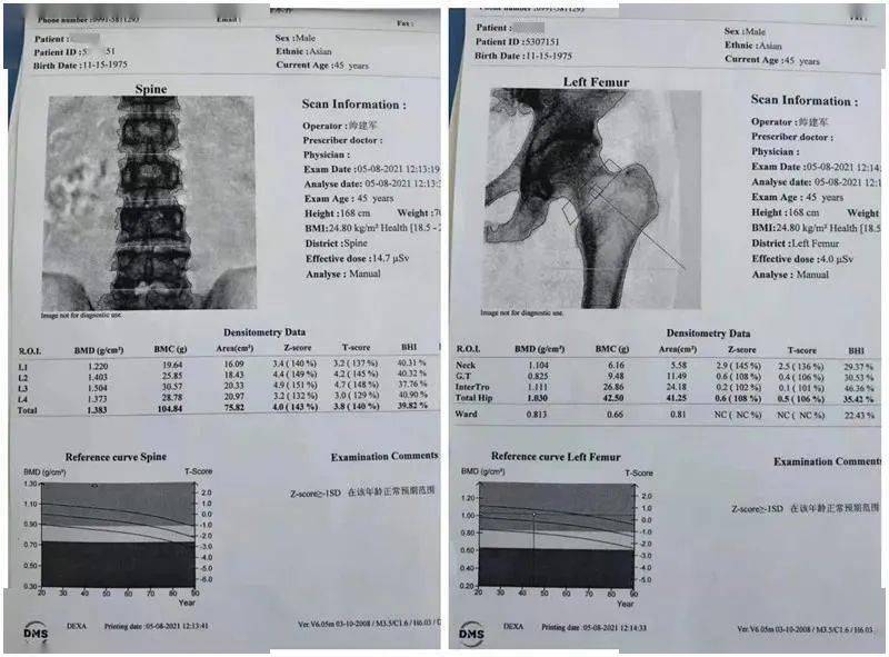 行走|【医文医话】罕见病例 | 低磷骨软化症确诊治疗始末